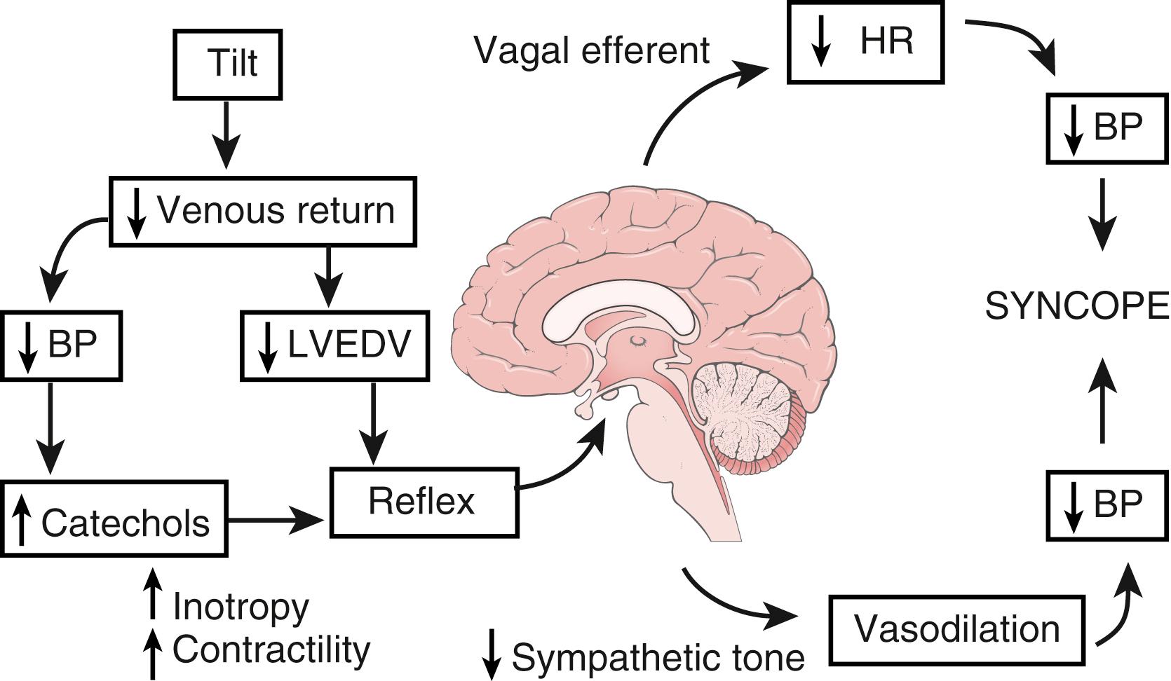 Fig. 7.1, Tilt-table testing: the Bezold-Jarisch reflex. BP, blood pressure; HR, heart rate; LVEDV, left ventricular end-diastolic volume.