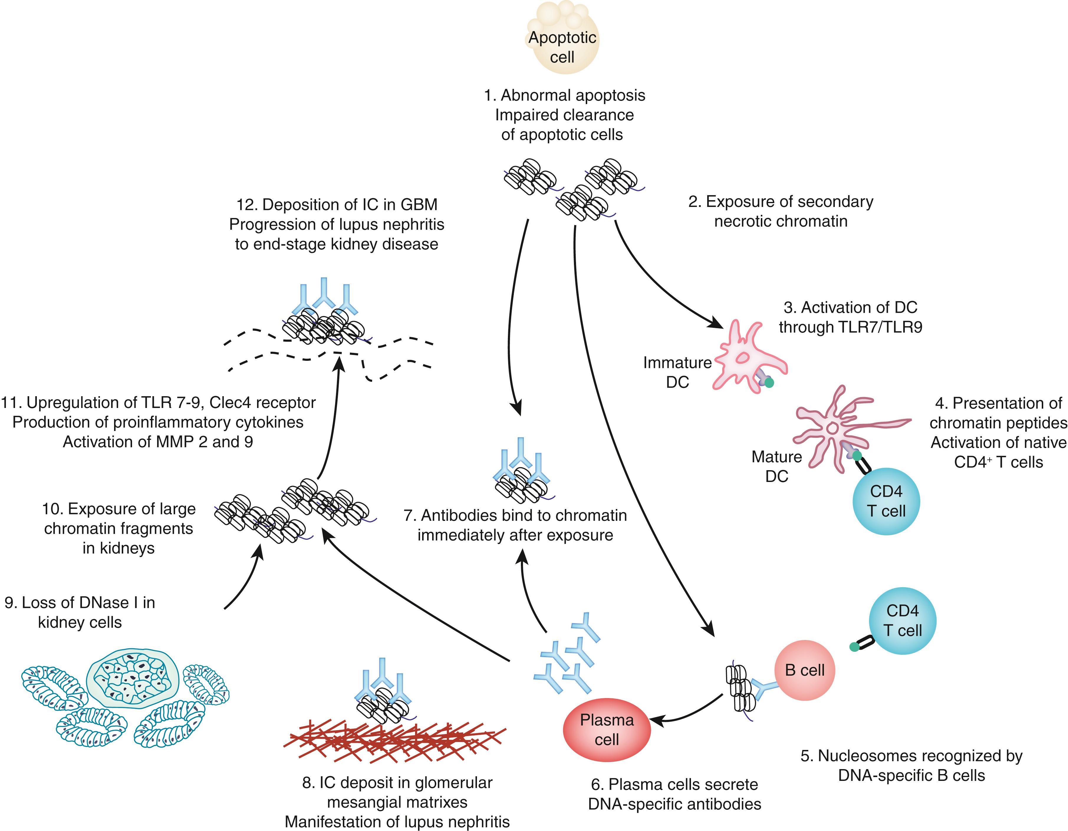 Fig. 23.3, The role of extracellular chromatin fragments and anti-dsDNA antibodies in progressive lupus nephritis. Retention of chromatin is assumed to start with reduced clearance of apoptotic cells (station 1). Secondary to this, chromatin may be exposed in tissues (station 2) and is assumed to activate dendritic cells (station 3). These cells present chromatin-derived peptides in the context of major histocompatibility complex (MHC) class II molecules to peptide-specific CD4+ T cells (station 4). When primed, the peptide-specific T cells recirculate and bind the same chromatin-derived peptides presented in the context of MHC class II by chromatin-specific B cells (here recognizing double-stranded DNA [dsDNA] in chromatin) (station 5). As a consequence of cognate interaction of dsDNA-specific B cells and peptide-specific CD4+ T cells, the B cells transform into plasma cells that secrete immunoglobulin (Ig)G anti-dsDNA antibodies (station 6), which bind chromatin fragments (station 7). Immune complexes that consist of IgG antibodies and chromatin fragments bind in the glomerular mesangial matrix and initiate mesangial lupus nephritis (station 8). This early inflammation is followed by silencing of renal DNAse I in tubular and glomerular cells (station 9) and accumulation of undigested chromatin fragments (station 10). These fragments promote upregulation of Toll-like receptors (TLRs), proinflammatory cytokines, and matrix metalloproteases (station 11). Finally, IgG autoantibodies recognize and bind the chromatin fragments, and these immune complexes deposit in the glomerular basement membranes (GBMs) and aggravate renal inflammation (station 12). In this sense, chromatin fragments and antichromatin (here: anti-dsDNA) antibodies are the partners that impose the classic murine and human lupus nephritis. Thus antichromatin antibodies are pathogenic only in the context of exposed chromatin structures. DC, Dendritic cell; GBM, glomerular basement membrane; IC, immune complex; TLR, Toll-like receptor.