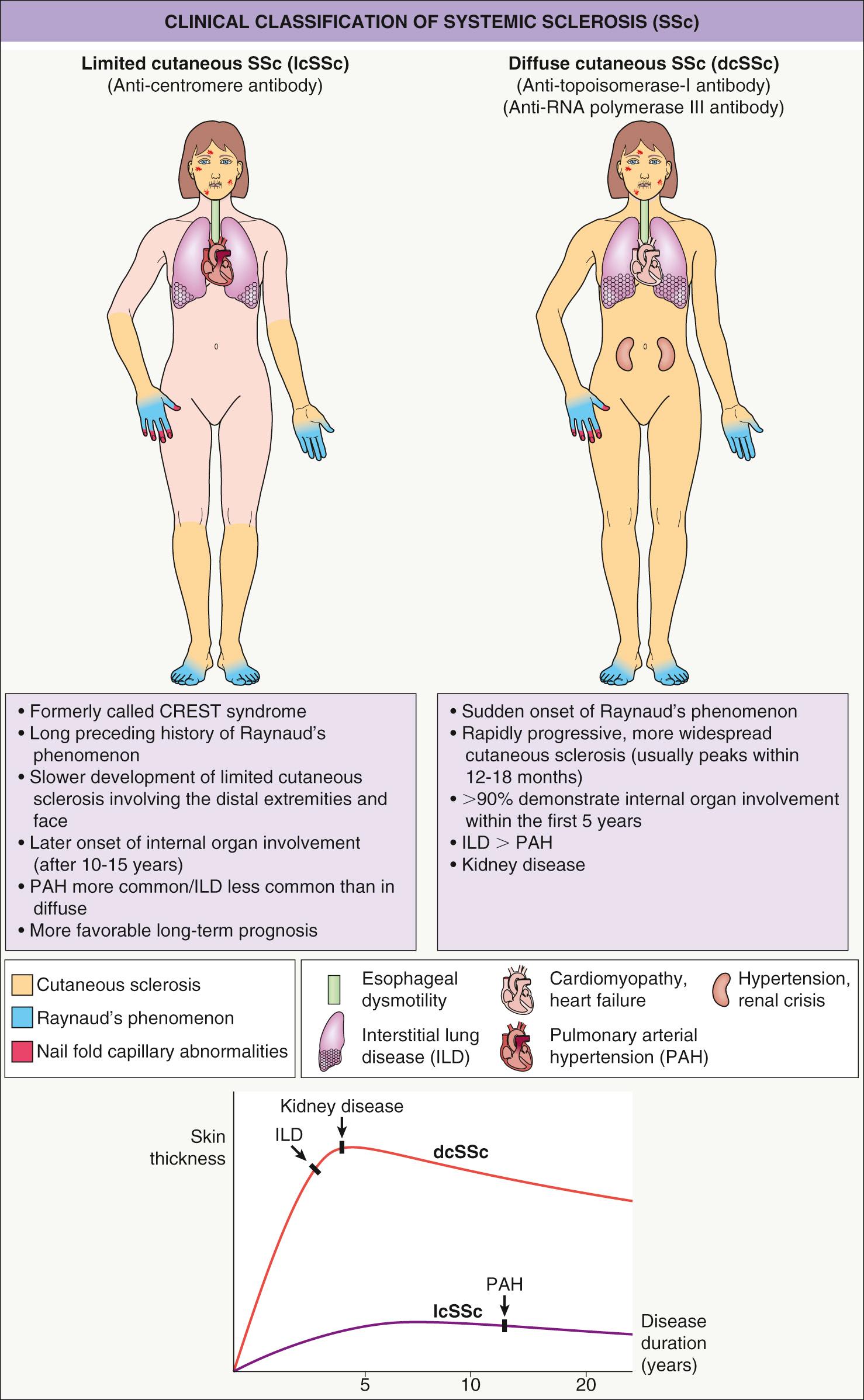 Fig. 43.2, Clinical classification of systemic sclerosis (SSc).
