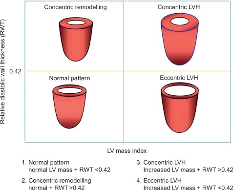 Figure 15.1, Left ventricular geometric patterns in arterial systemnic hypertension.