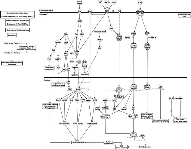 Figure 13.1, Pathway View of Pancreatic Ductal Adenocarcinoma.