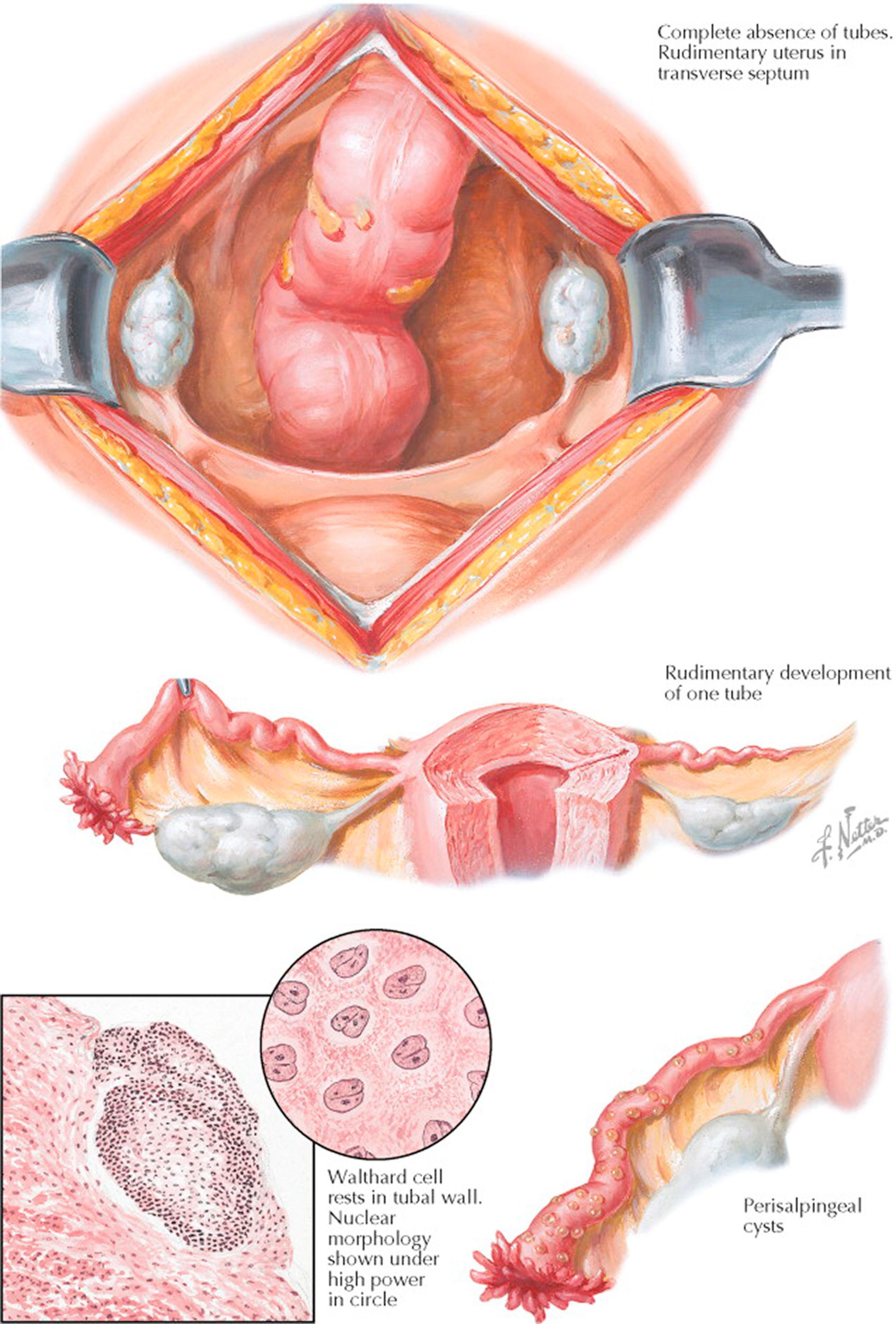 Plate 9-2