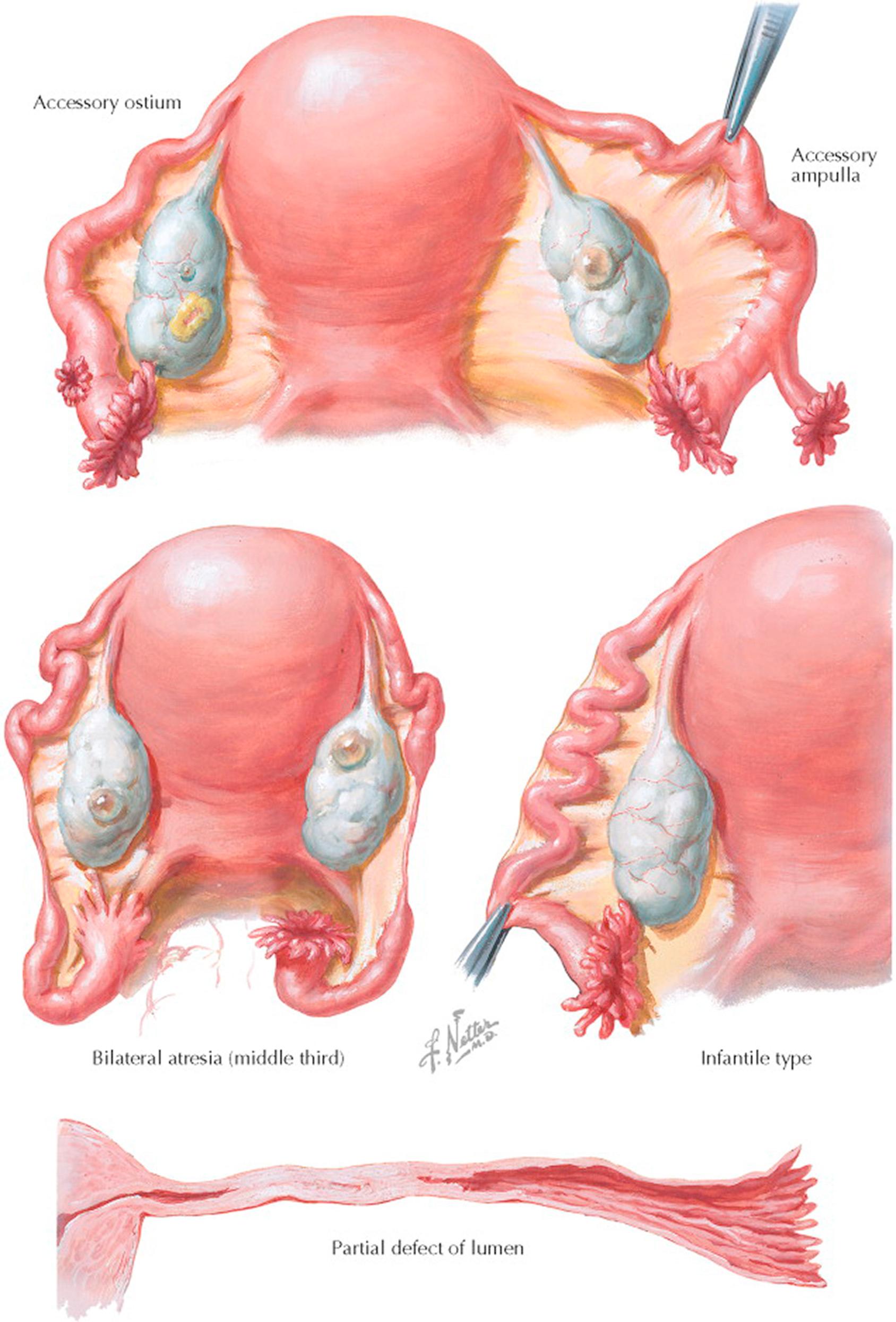 Plate 9-3