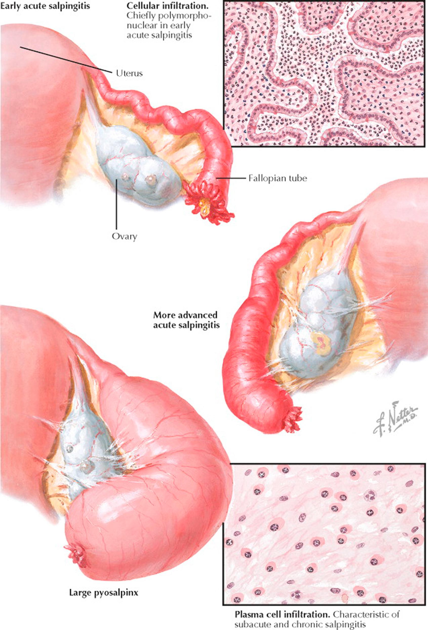 Plate 9-5