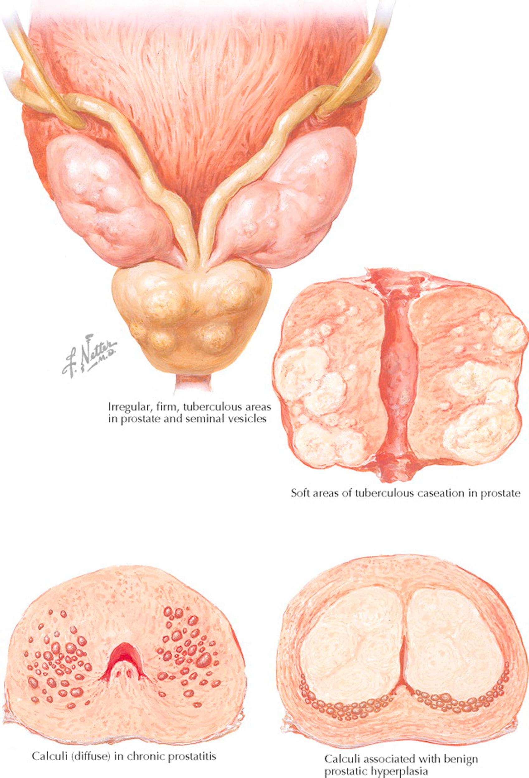 Plate 4-6