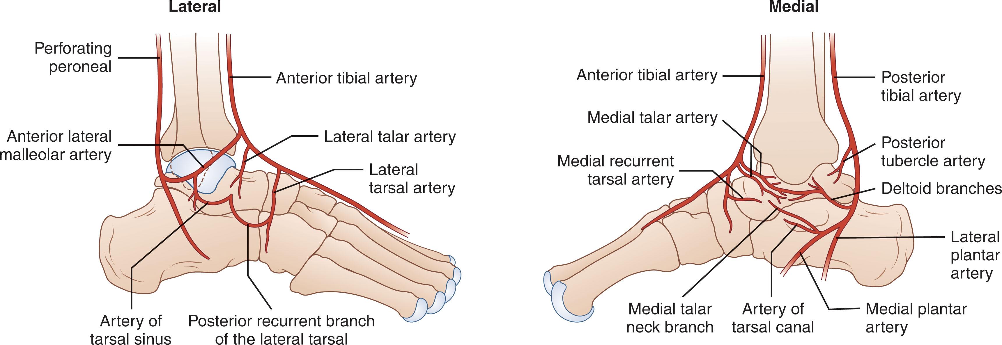 Fig. 46-5, Schematic of the arterial supply of the talus.