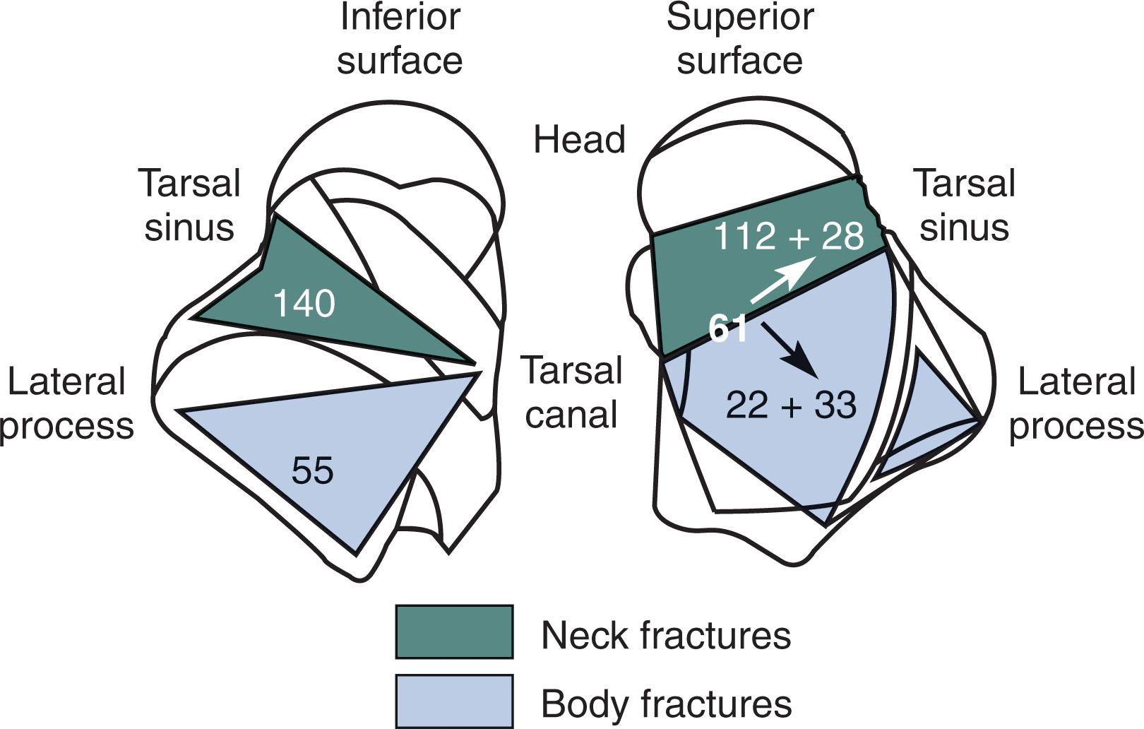 Fig. 46-7, Talar neck and talar body fractures can be accurately distinguished by evaluating the position from which the fracture line exits the talus at the level of the subtalar joint. Numbers indicate number of cases with each pattern.