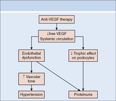 Fig. 17.5, Summary of the antivascular endothelial growth factor (anti-VEGF) therapy on blood pressure and podocytes.