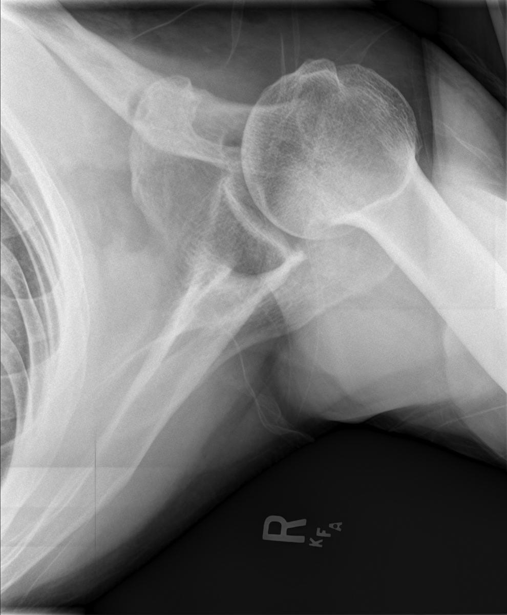 Fig. 14.4, Postoperative axial view.