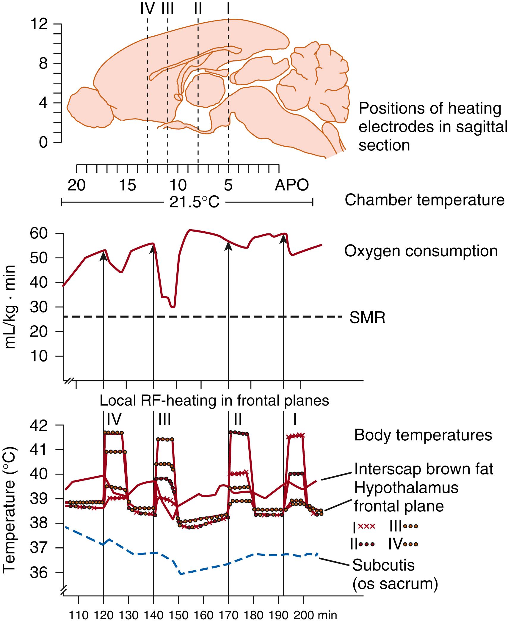 Fig. 42.5, Effect of local radio frequency (RF) heating in different frontal planes of the hypothalamus on nonshivering thermogenesis (NST) induced by external cooling in a newborn guinea pig (for these small animals, an ambient temperature of 21.5°C is below neutral temperature). The upper part of the figure shows the projection of the four implanted electrodes on the sagittal section of the brain. The different frontal planes were locally heated in succession. Only heating of plane III, corresponding to the preoptic area and anterior hypothalamus, resulted in an almost complete suppression of the cold-induced NST (note reduction of the temperature within the interscapular brown fat). APO, Apomorphine; SMR, oxygen uptake corresponding to standard metabolic rate.