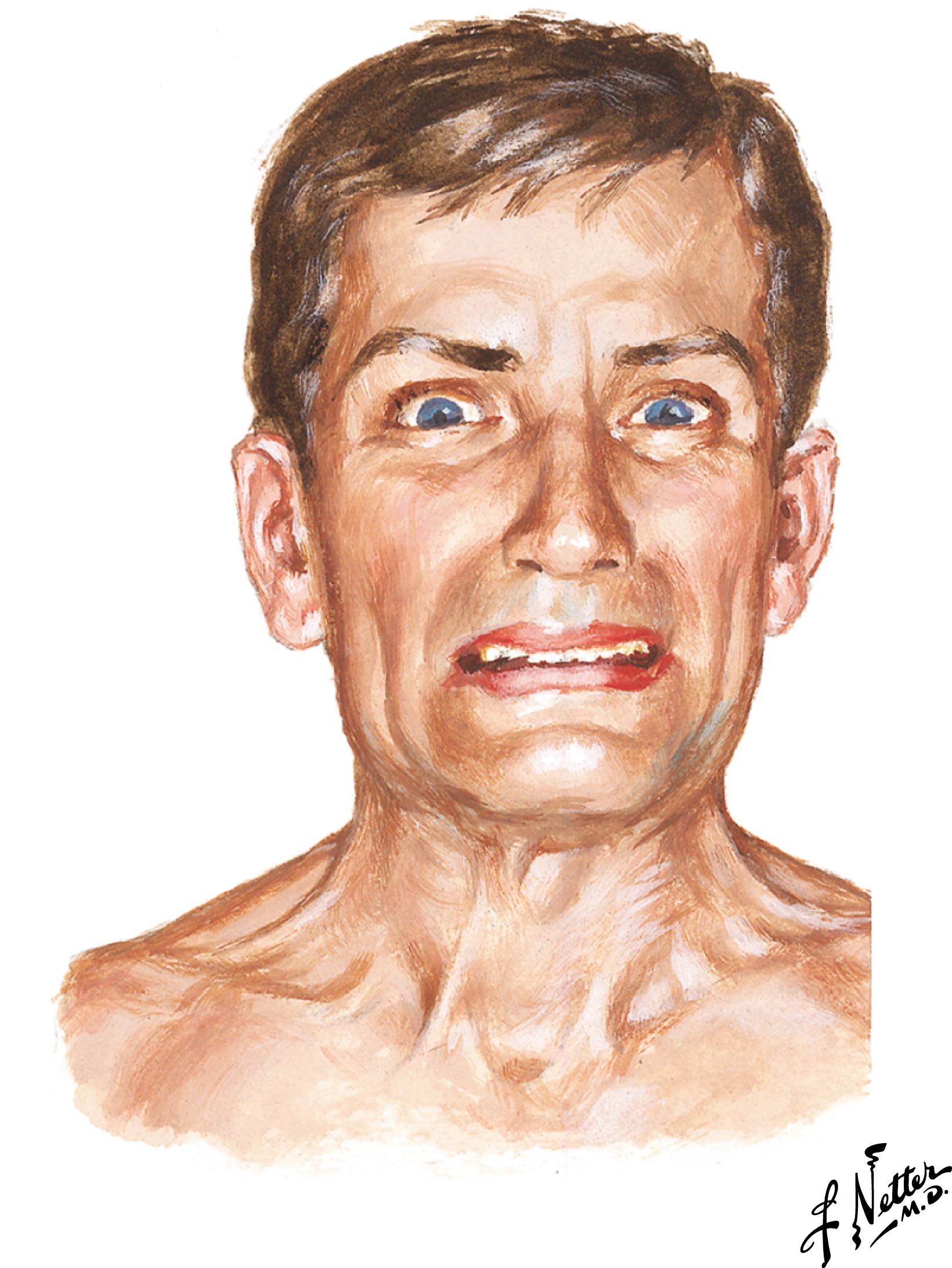 Figure 2-13, Temporomandibular joint pain.