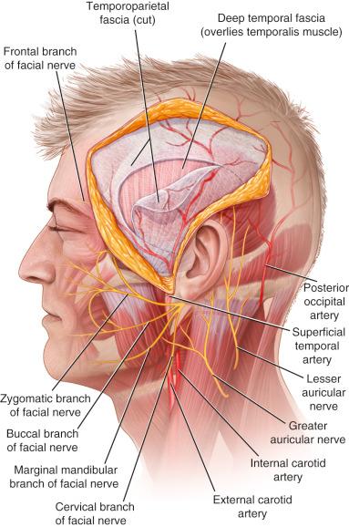 Figure 32.1, Temporoparietal fascia flap.