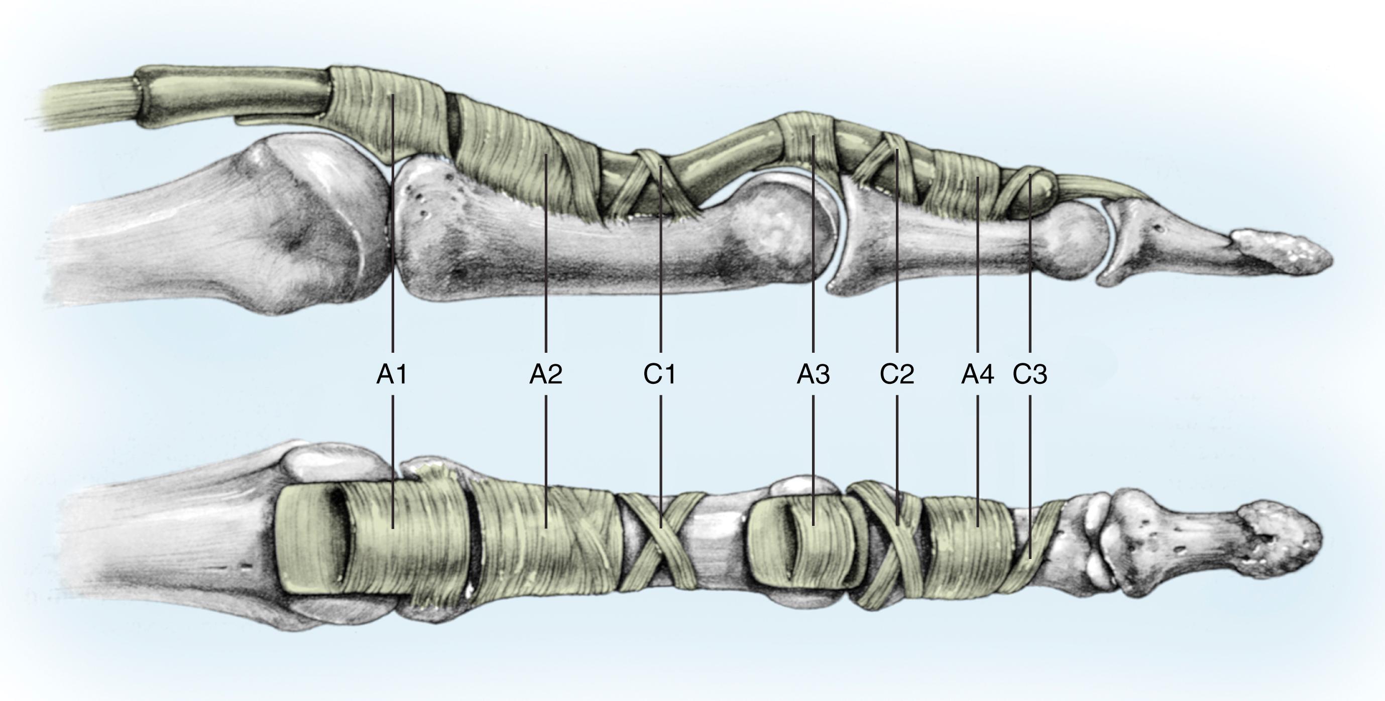 Fig. 56.1, Doyle and Blythe have identified four annular and three cruciform pulleys in the fingers.