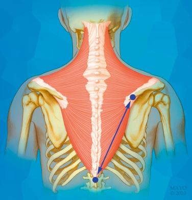 FIG. 37.3, Origin of the lower trapezius on the thoracolumbar fascia and insertion on the medial scapular spine.