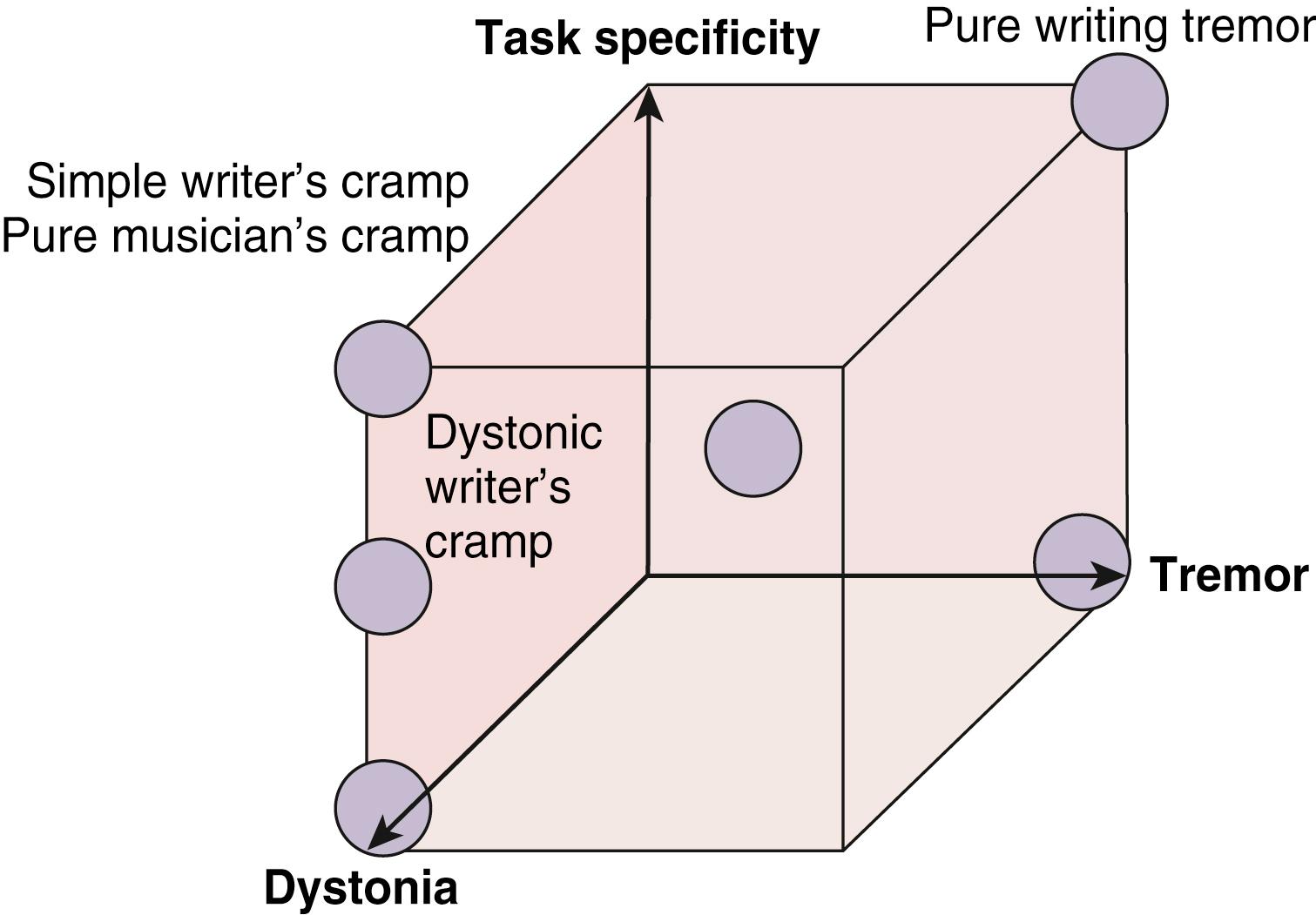 Figure 119.1, Concept of three components in focal hand dystonia.