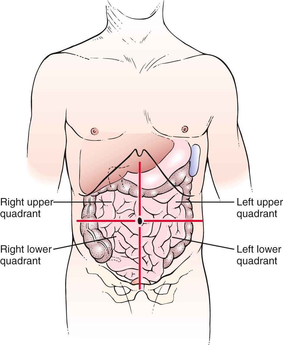 Fig. 17.1, The Four Abdominal Quadrants.