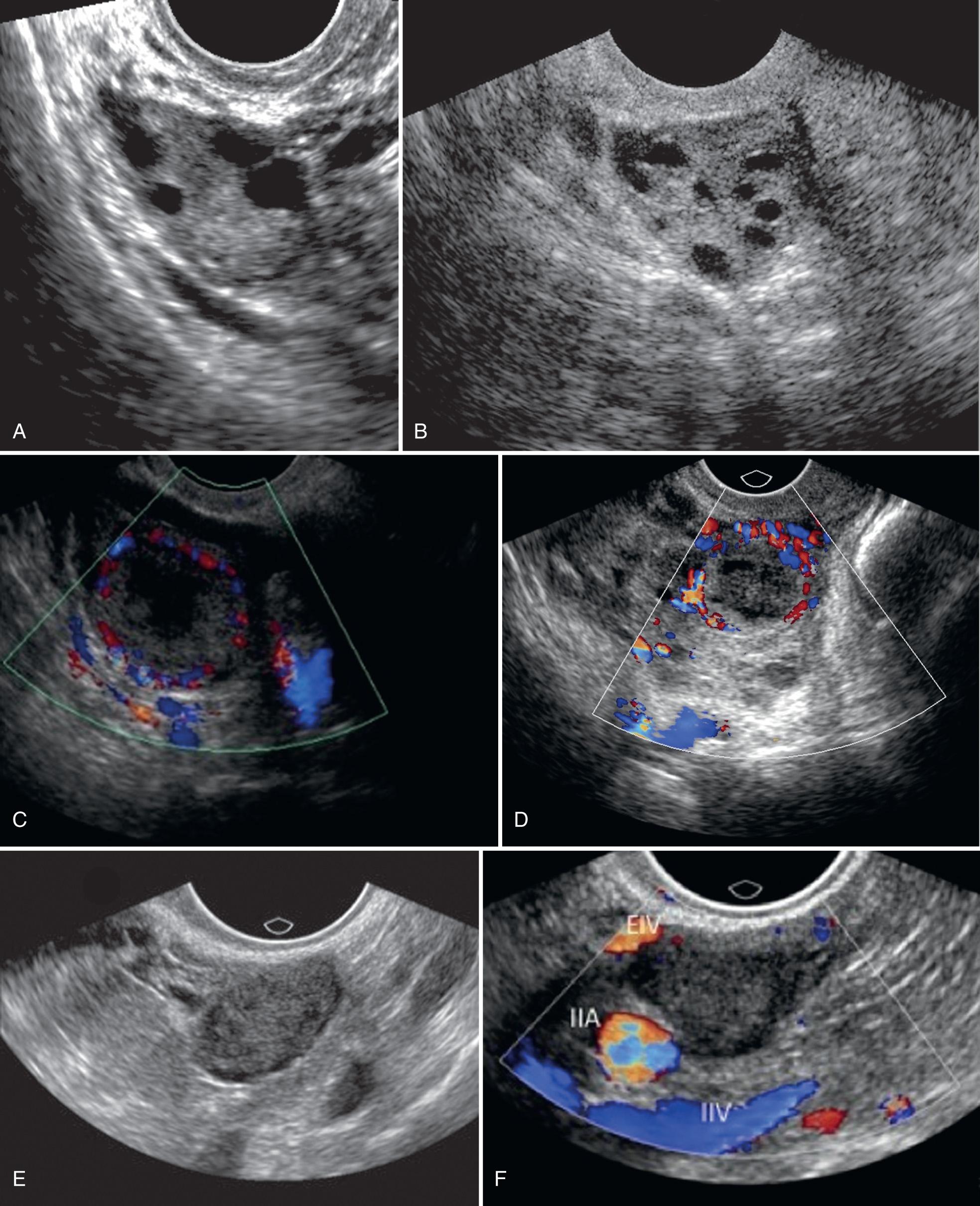 FIG. 16.3, Normal Ovary.