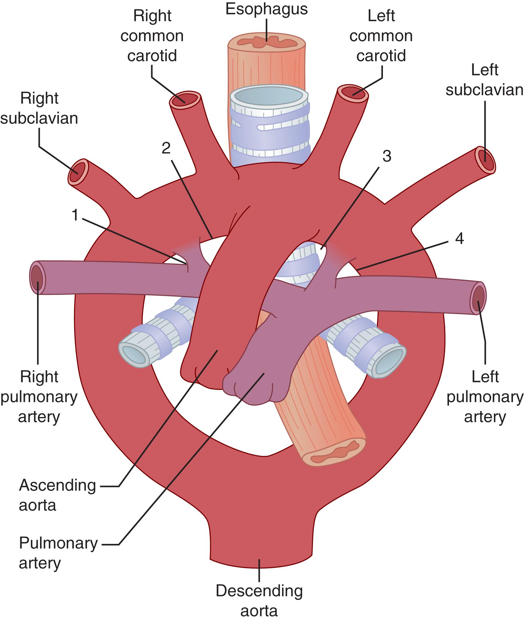 Fig. 62.2, Edwards theoretical arch.