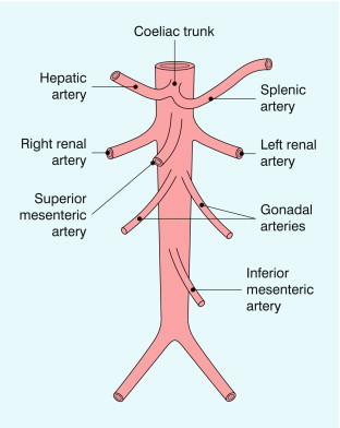 FIGURE 6-1, The abdominal aorta and its major branches.