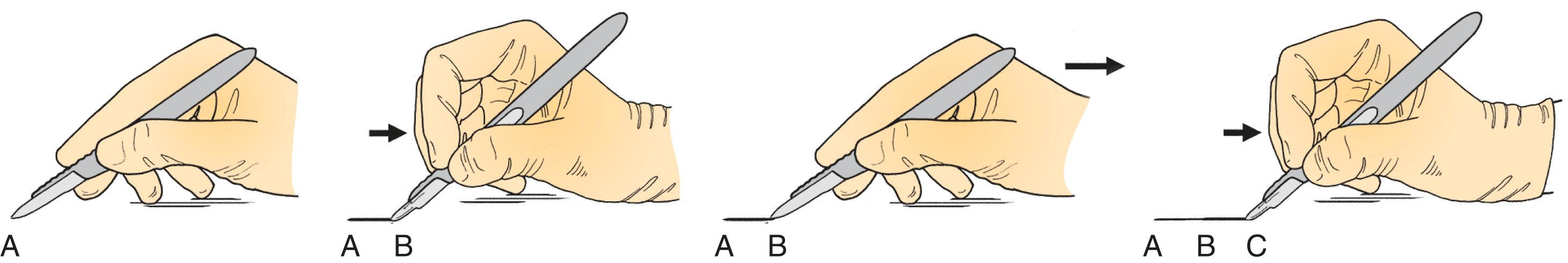 Figure 1.4, Flexion of the fingers with the scalpel blade followed by movement of the hand.