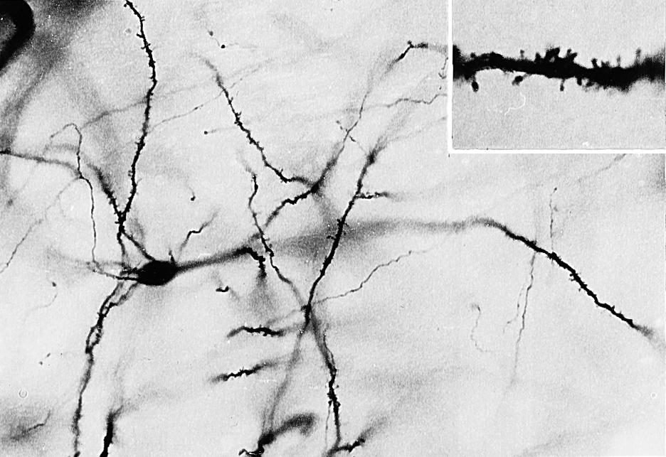 Fig. 26.6, Medium spiny neuron from the primate neostriatum. The detail shows the characteristic appearance of dendritic spines on these cells.