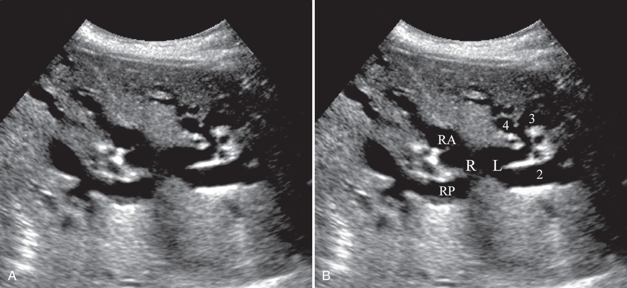 FIG. 6.3, Typical Ductal Branching Order.