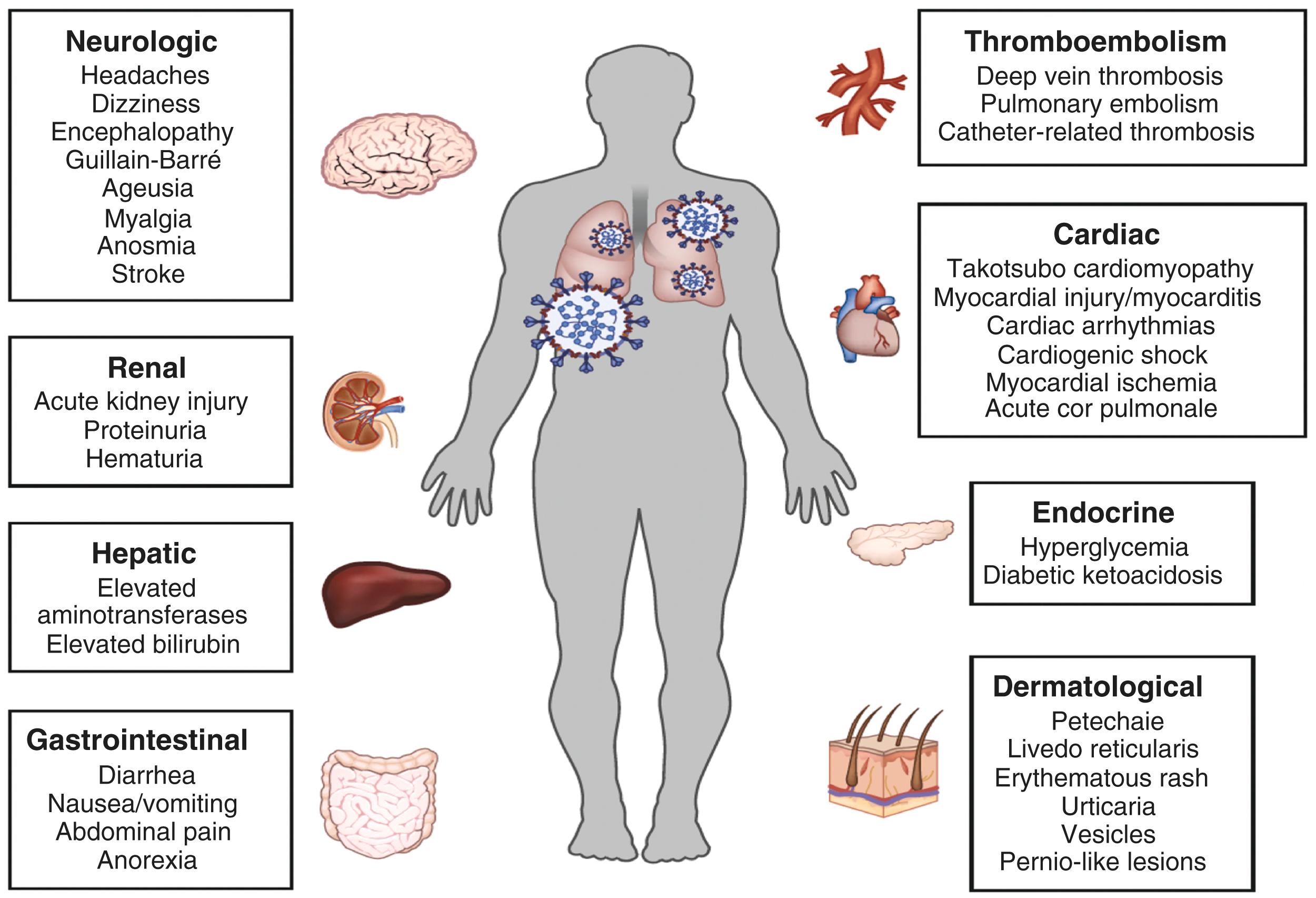 Figure 4.2, Extrapulmonary manifestations of COVID-19. The pulmonary manifestations of COVID-19 caused by infection with SARS-CoV-2, including pneumonia and ARDS, are well recognized. In addition, COVID-19 is associated with deleterious effects on many other organ systems. Common extrapulmonary manifestations of COVID-19 are summarized here. ARDS , acute respiratory distress syndrome; COVID-19 , coronavirus disease 2019; SARS-CoV-2 , severe acute respiratory syndrome coronavirus 2.