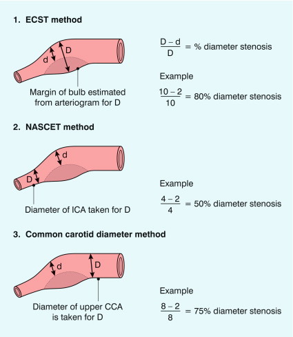 FIGURE 3-1, Methods for estimating percentage diameter stenosis in arteriography.