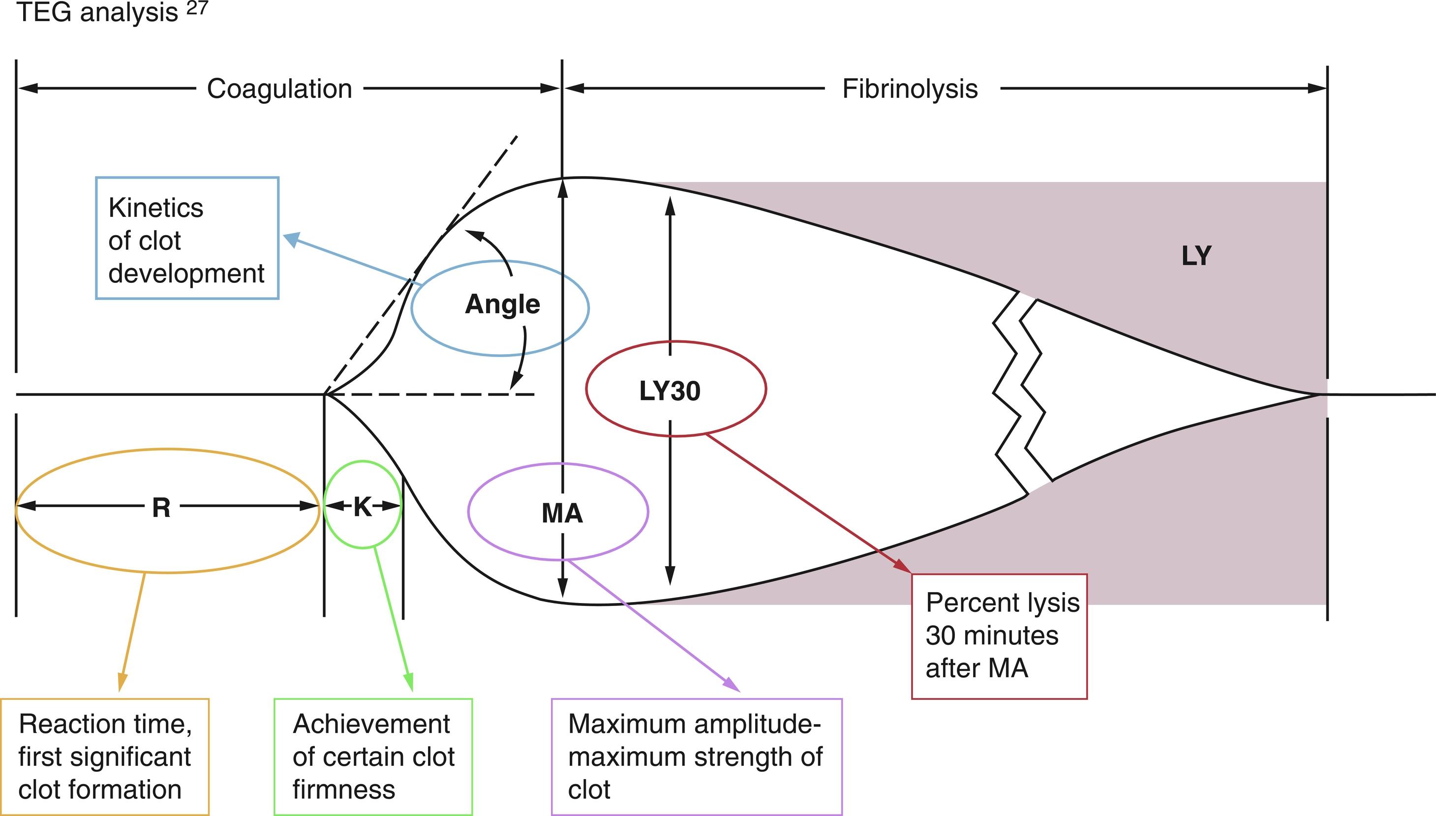 Fig. 3.2, Thromboelastographic analysis. K , K-value; LY30 , time at 30 minutes; MA , maximum amplitude; R , R-value = reaction time.