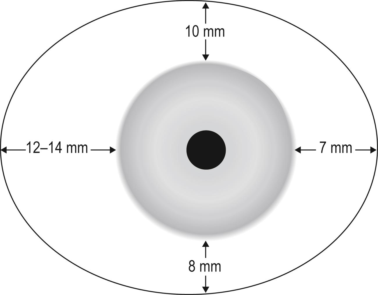 Fig. 2.2, Geography of the fornices. Distance from the corneoscleral limbus to the fornix.