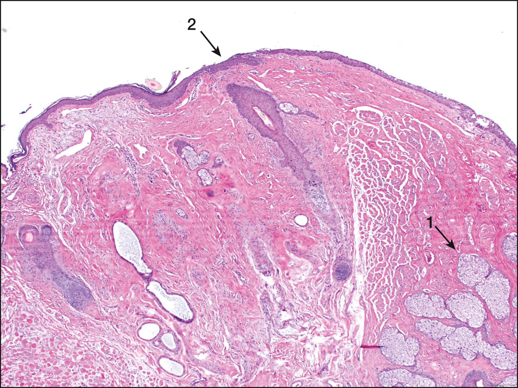 Fig. 2.5, Histologic section through the upper eyelid. Meibomian glands (1) and the mucocutaneous junction (2) can be seen.