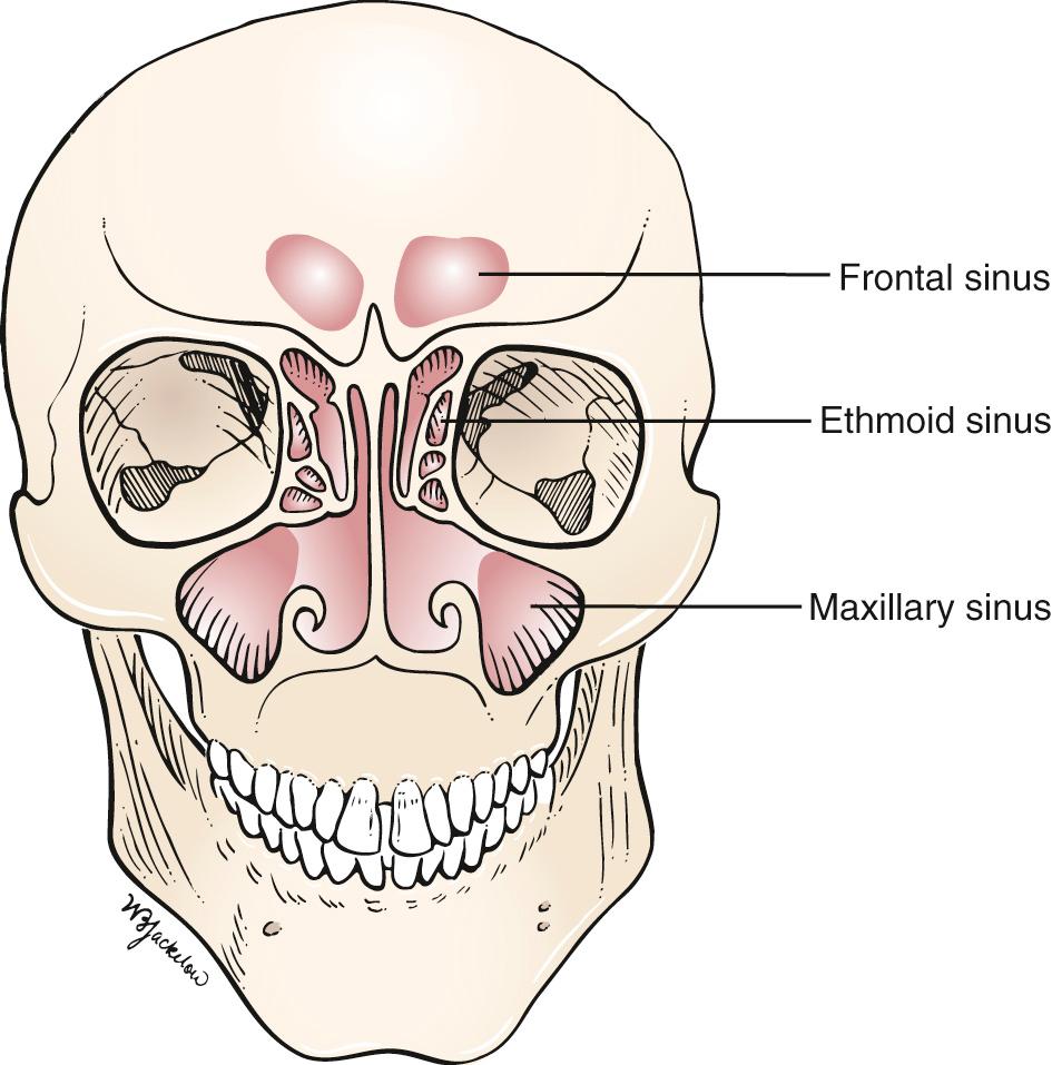 Fig. 11.9, Nasal Sinuses.