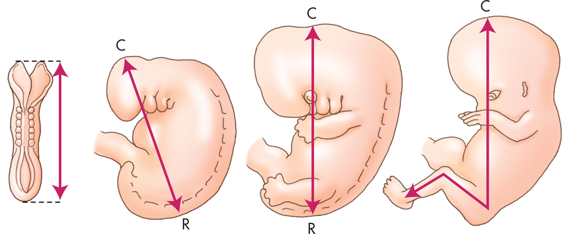Fig. 49.5, The relationship of neural tube development to crown-rump length in the first trimester. Note the size of the embryo’s head relative to the body. At the beginning of the fetal period in the late first trimester, the embryo’s head measures almost half of the crown-rump length.