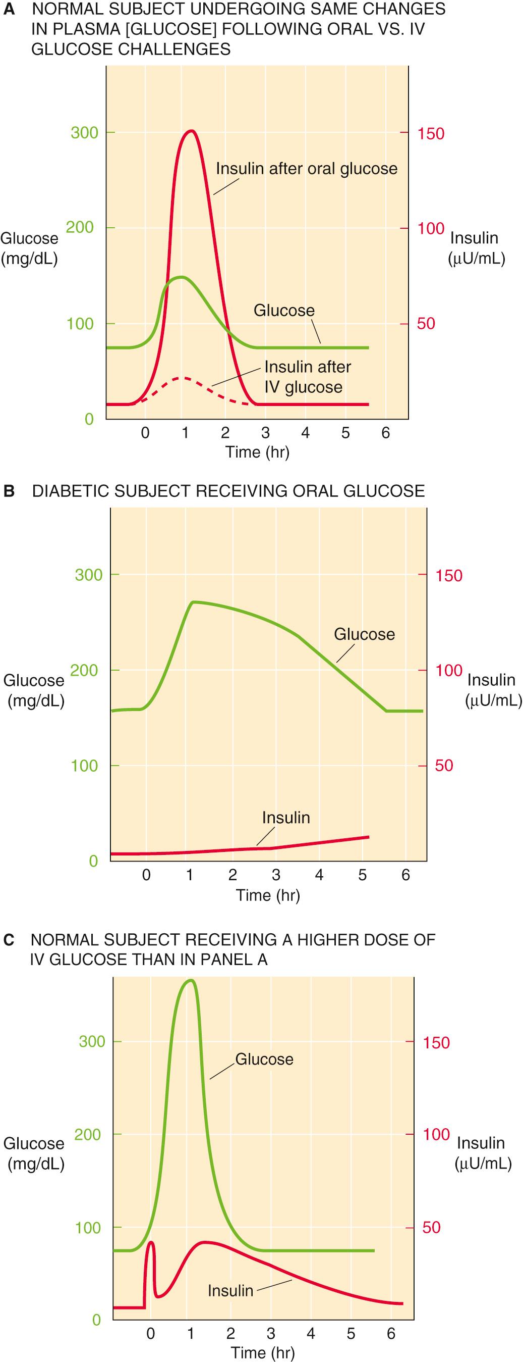 Figure 51-3, Glucose tolerance test results. A, When a person ingests a glucose meal (75 g), plasma [glucose] (green curve) rises slowly, reflecting intestinal uptake of glucose. As a result, plasma [insulin] ( solid red curve) rises sharply. When a lower glucose dose is given intravenously (IV) over time—in a manner that reproduces the green curve—plasma [insulin] rises only modestly (dashed red curve). The difference between the insulin responses indicated by the solid and dashed red lines is due to the “incretin effect” of oral glucose ingestion. B, In a patient with type 1 diabetes, the same oral glucose load as that in A causes plasma [glucose] to rise to a higher level and to remain high for a longer time. The diagnosis of diabetes is made if the plasma glucose level is above 200 mg/dL at the second hour. C, If a large IV glucose challenge (0.5 g glucose/kg body weight given as a 25% glucose solution) is administered as a bolus, plasma [glucose] rises much more rapidly than it does with an oral glucose load. Sensing a rapid rise in [glucose], the β cells first secrete some of their stores of presynthesized insulin. Following this “acute phase,” the cells secrete both presynthesized and newly manufactured insulin in the “chronic phase.”