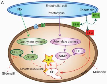 FIGURE 37.3, A, Nitric oxide (NO) produced by nitric oxide synthase (NOS) in endothelial cells diffuses into subjacent smooth muscle cells, interacts with soluble guanylate cyclase, and increases the concentration of cyclic guanosine monophosphate (cGMP) to cause vascular relaxation. The effect of NO is decreased by metabolism of cGMP by specific phosphodiesterases (PDE). B, Treatment algorithm for PPHN. ECMO, extracorporeal membrane oxygenation; F i O 2 , fraction of inspired oxygen; l -arg, l -arginine; MAP, mean arterial pressure; OI , oxygenation index; P/F , Pa o 2 /Fraction of inspired oxygen; Pa o 2 , arterial oxygenation; PEEP, positive end-expiratory pressure; Sp o 2 , oxygen saturation as measured by pulse oximetry; SR, sarcoplasmic reticulum.