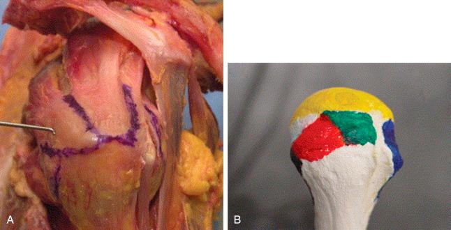 FIG. 33.14, (A) Lateral view of intact myotendinous units with intervals marked prior to dissection. (B) Model showing footprints of the supraspinatus (green) and infraspinatus (red). The subscapularis footprint (blue) is anterior to the biceps groove.