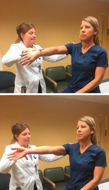 FIG. 33.8, Active compression test: Top: Flex shoulder 90 degrees and adduct the shoulder across the body, thumb down. Patient is to resist downward force (shoulder internal rotation, forearm pronated). Bottom: Repeat with thumb up (shoulder external rotation, forearm supinated). Positive test result is pain with thumb down, alleviated with palm up. Suggests biceps labral anchor lesion (superior labrum tear from anterior to posterior)