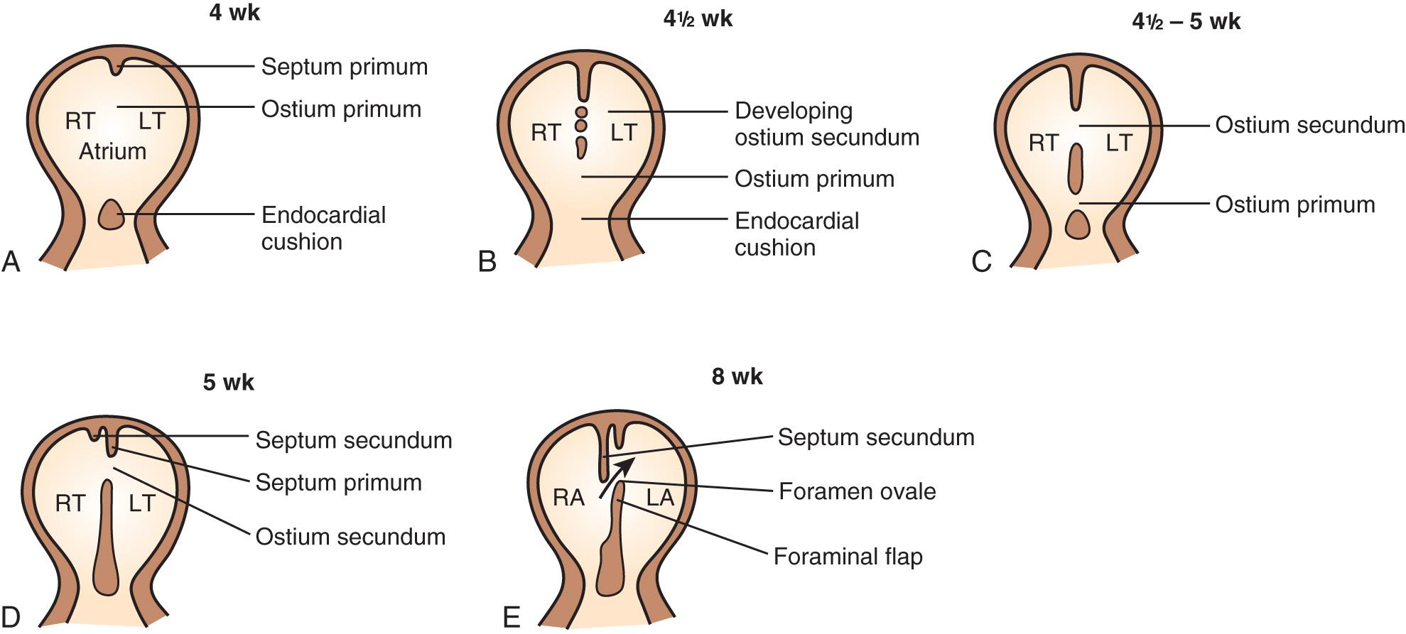 FIG. 37.19, Development of Intraatrial Septum (Viewed Facing Patient).