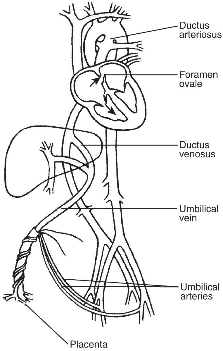 FIG. 37.2, Diagram of Fetal Shunts.