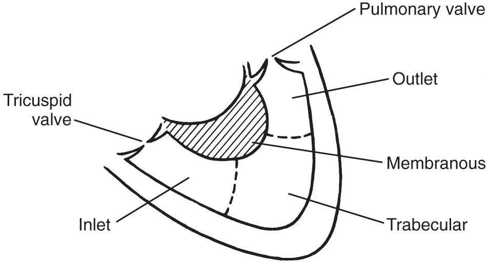 FIG. 37.23, Interventricular Septum Viewed From Right Ventricle.