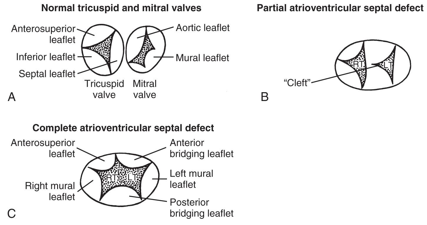 FIG. 37.26, Valve Leaflet Morphology.