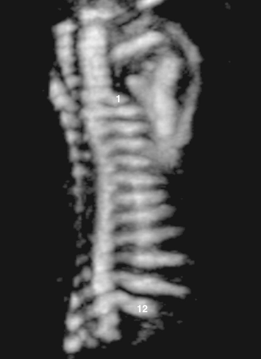 FIG. 40.8, Normal Ribs: Three-Dimensional Ultrasound.