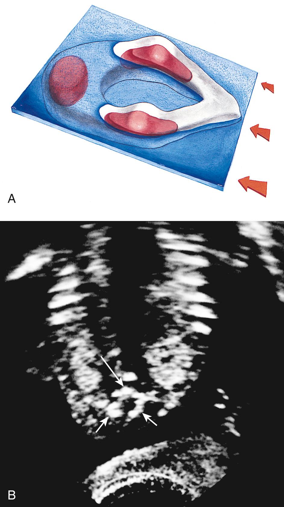 FIG. 35.11, Posterior Angled Transaxial (Transverse) Scan Plane.