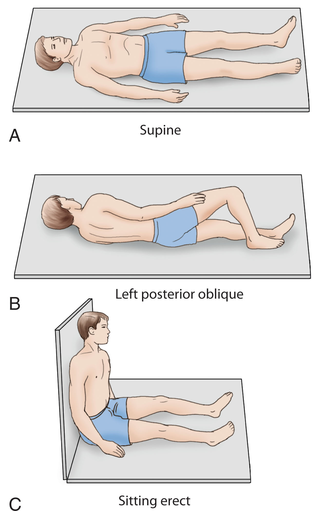 Fig. 10.8, (A–C) The gallbladder should be examined with the patient in the supine (A), left posterior oblique (B), and sometimes upright positions (C).