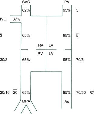 Fig. 14.3, Representative blood oxygen saturation (%) and pressure (mm Hg) in various cardiac chambers and vessels in the normal newborn infant. Ao, Aorta; IVC, inferior vena cava; LA, left atrium; LV, left ventricle; MPA, main pulmonary artery; PV, pulmonary vein; RA, right atrium; RV, right ventricle; SVC, superior vena cava.