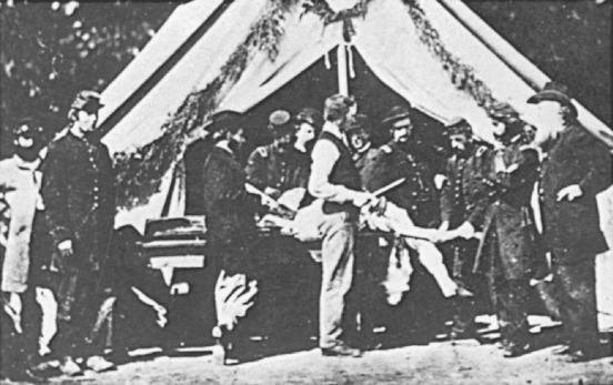 Fig. 74.12, Amputation scene at General Hospital during the American Civil War. Stereoscopic slide.