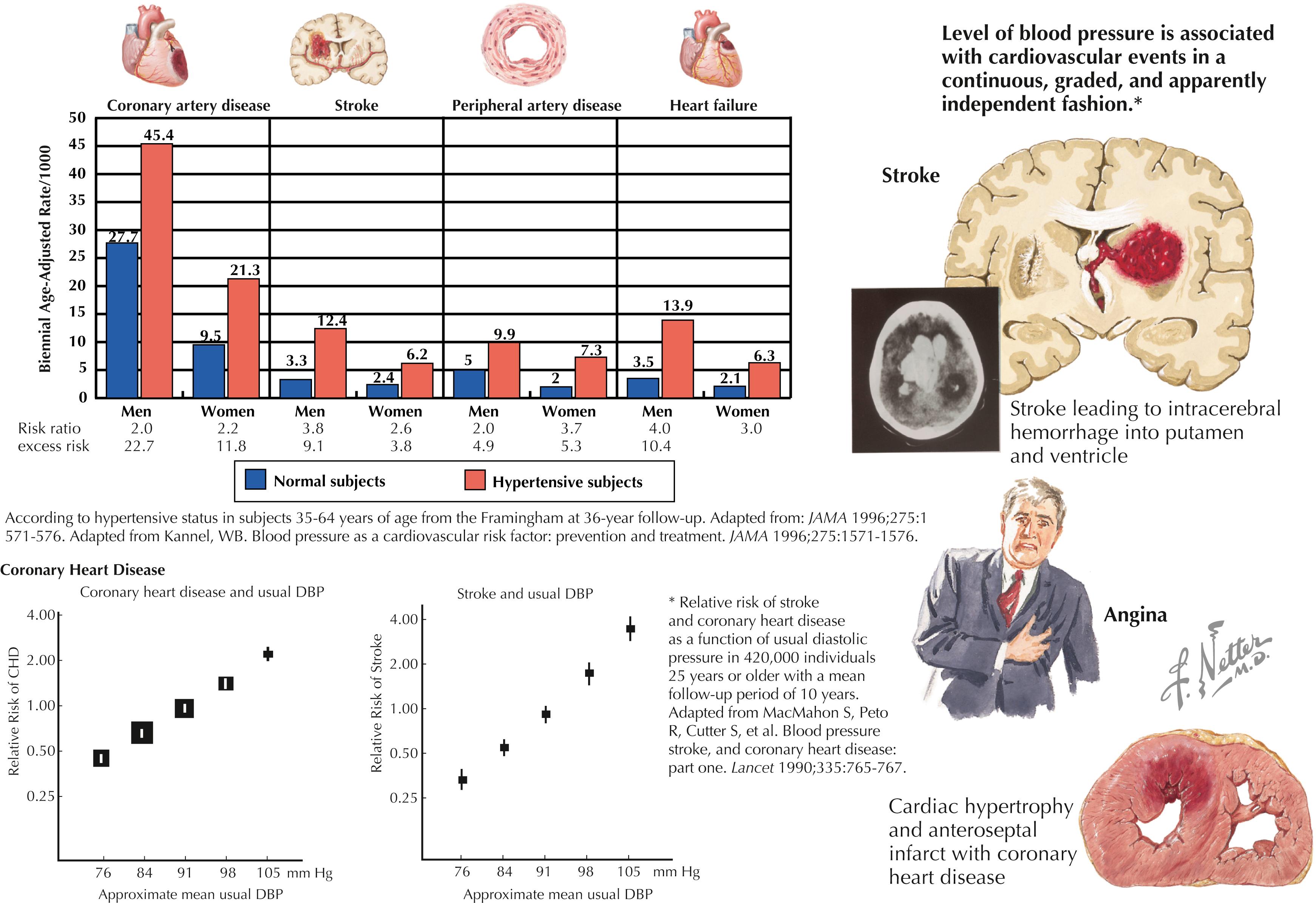 Figure 36.1, Hypertension as a risk factor for cardiovascular disease.