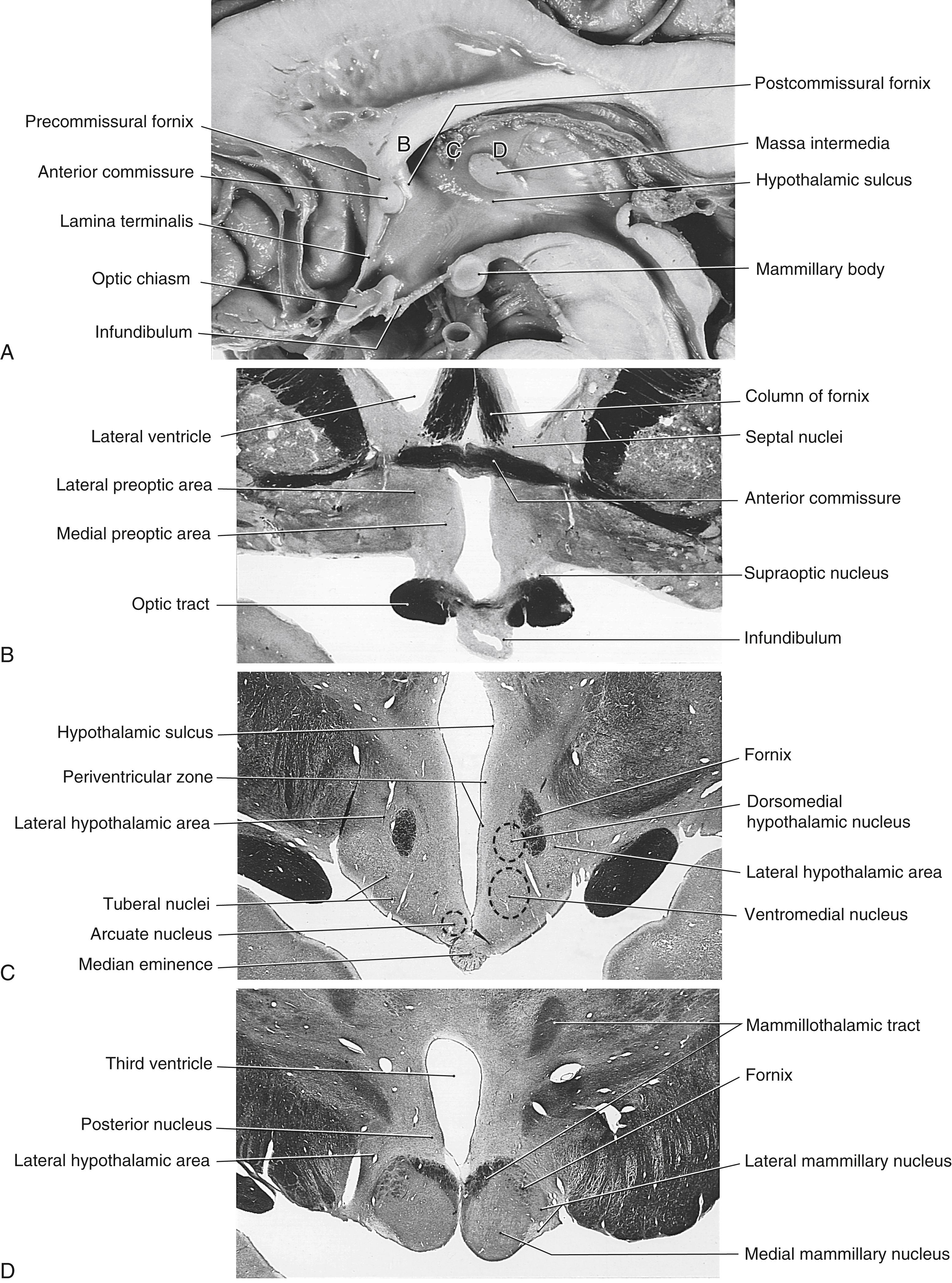 Fig. 30.2, Midsagittal view ( A ) of the brain emphasizing hypothalamic structures. Cross sections of the hypothalamus through preoptic ( B ), tuberal ( C ), and mammillary ( D ) regions. The myelin-stained sections in B, C, and D correspond to the comparably labeled lines in A.