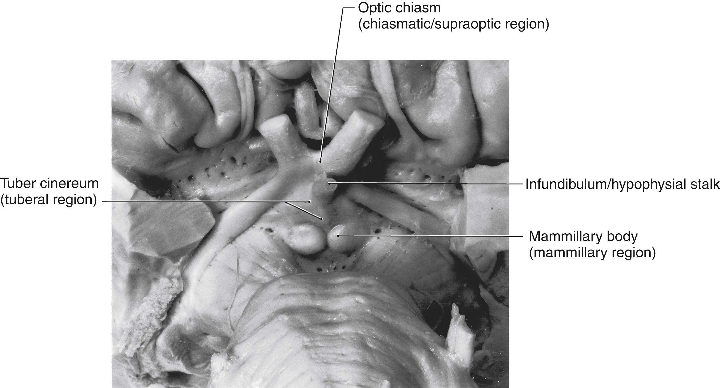 Fig. 30.6, The inferior aspect of the forebrain showing the external structures that correspond with the locations of the three internal regions that collectively comprise the medial hypothalamic zone; each region has its own respective nuclei (compare with Figs. 30.4 and 30.5 ). The internal region appears in parentheses under the name of the corresponding external structure.