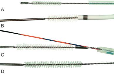 FIG 60.1, Brushes for endoscopic retrograde cholangiopancreatography (ERCP) brush cytology. From top to bottom: A, Standard metal-tipped brush, B, Geenen spring-nosed brush in a diagnostic catheter, C, Cytomax 8-Fr brush catheter over a 0.035-inch guidewire, D, large HBIB brush for use in the Howell biliary introducer (HBI).